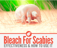 Does Bleach Kill Scabies & Bleach Baths for Scabies